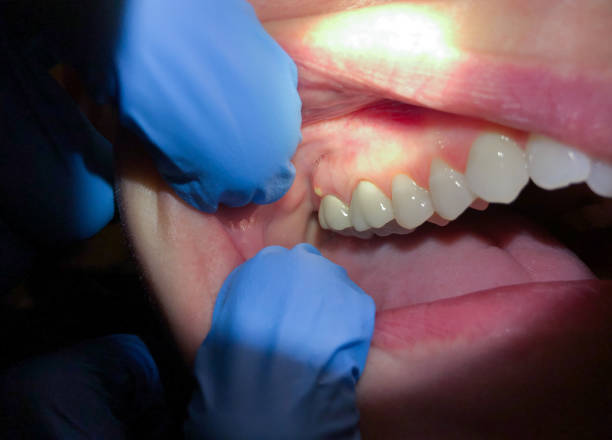 Best Chipped Tooth Repair Near Me  in Harrisburg, PA